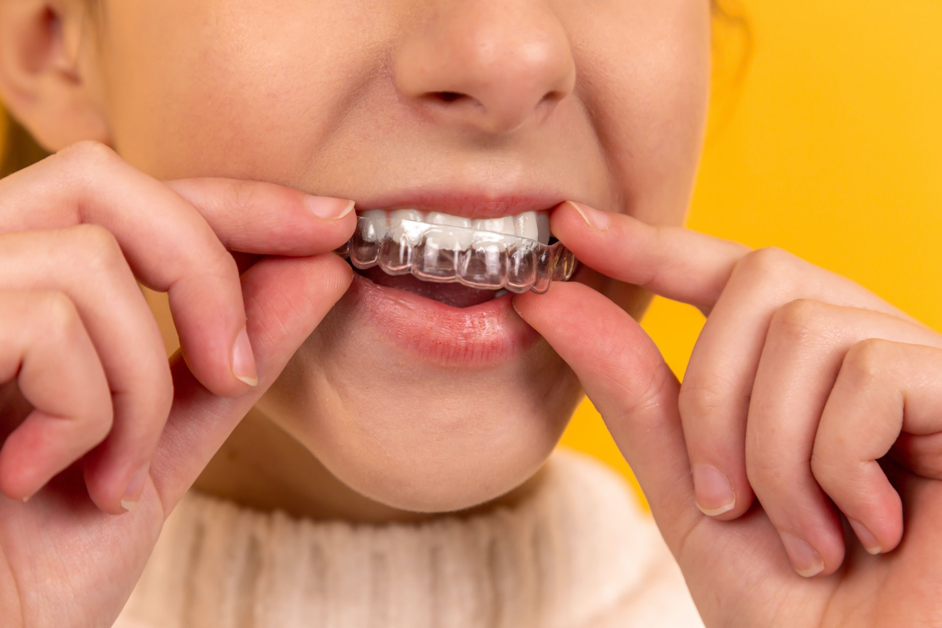The Ultimate Guide to Choosing the Right Braces for You