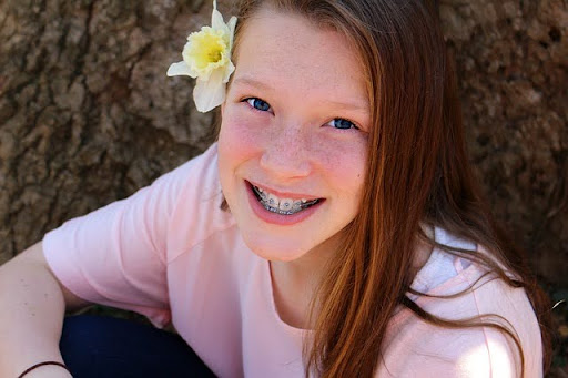 Relief for Common Braces Issues | Orthodontist 92807